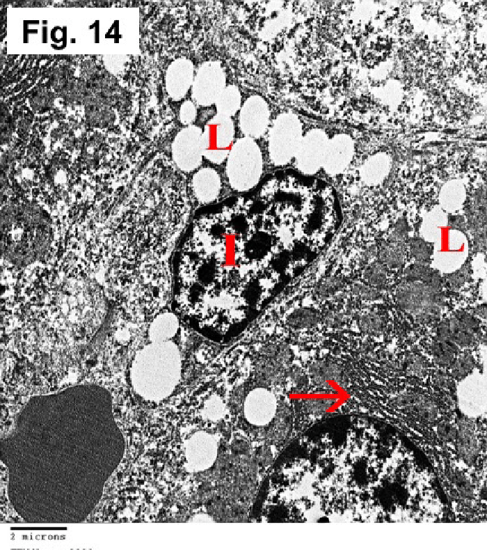 https://www.researchgate.net/profile/Nevine_Bahaa/publication/323001572/figure/fig11/AS:591573704265734@1518053570806/Control-group-showing-space-of-Disse-containing-Ito-cell-I-closely-related-to.png